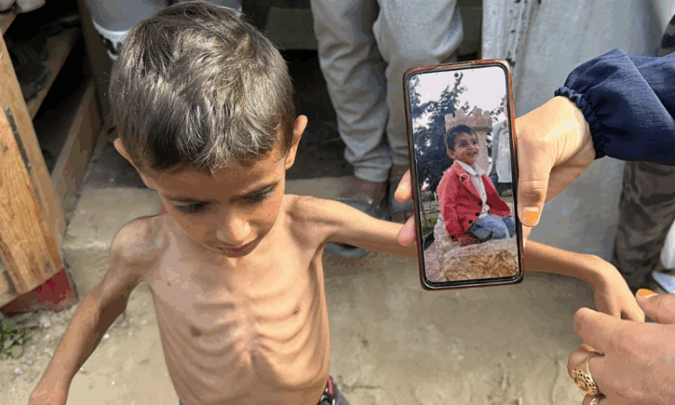 Thousands of Gaza’s children face imminent death under Israeli siege: UN