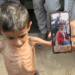 Thousands of Gaza’s children face imminent death under Israeli siege: UN