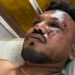 British passenger in seat 11A survives deadly Air India crash