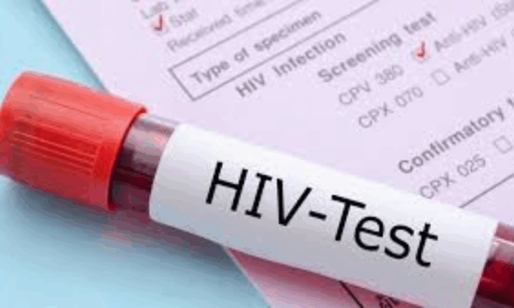Khyber-Pakhtunkhwa reports nearly 40,000 HIV/AIDS cases amid rising new infections